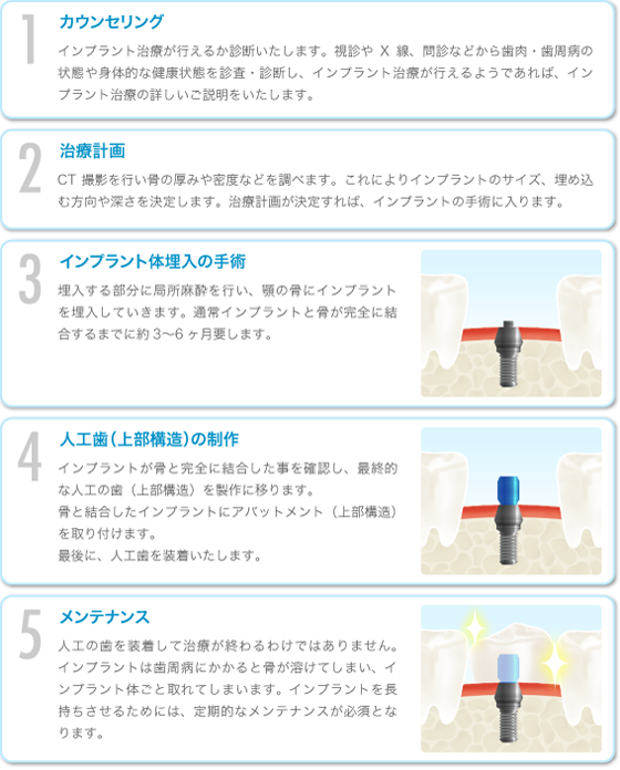 imp_images_21 imp_images_21